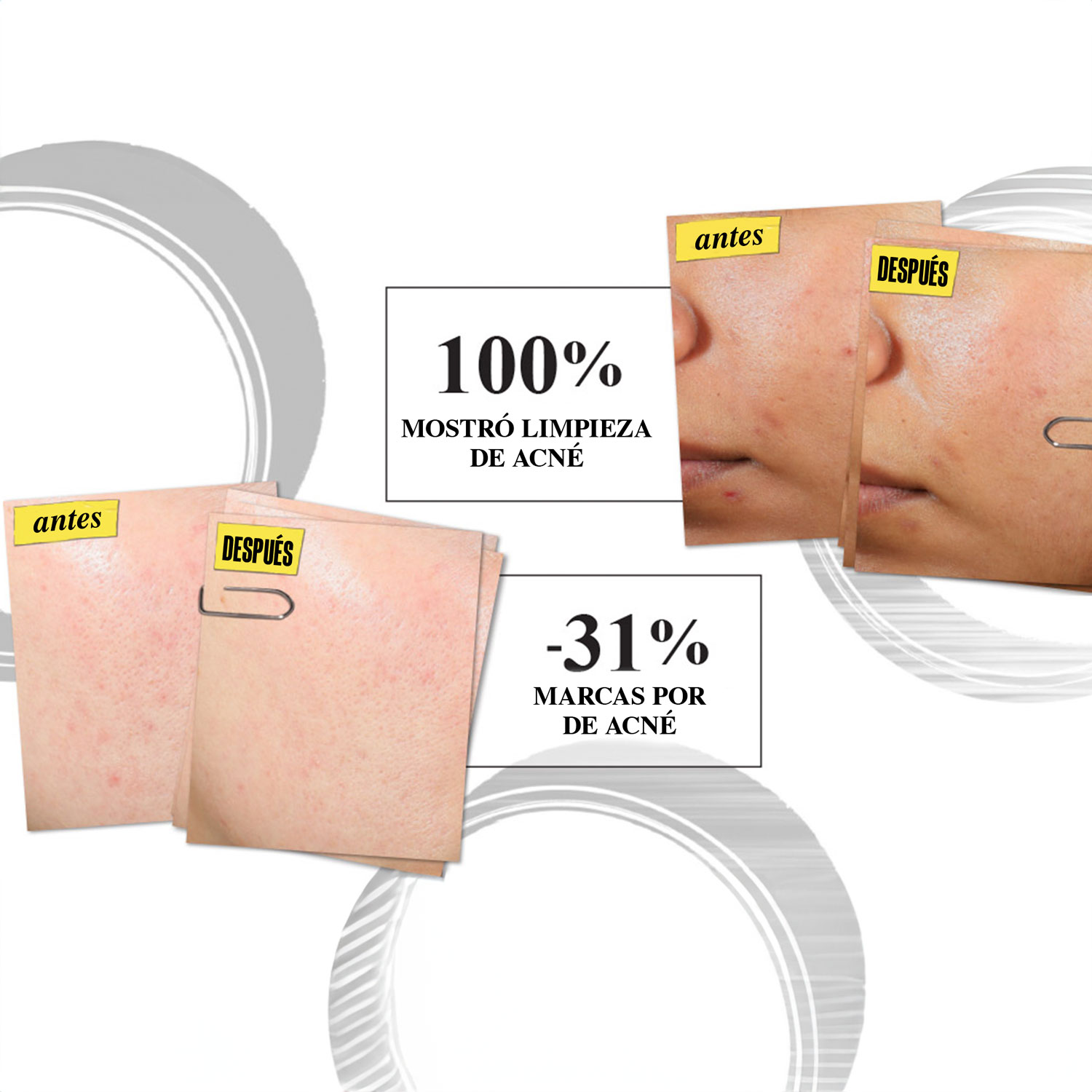 FACE EXPERTLY CLEAR BLEMISH TREATING AND PREVENTING LOTION (TRATAMIENTO HIDRATANTE PARA ACNÉ)